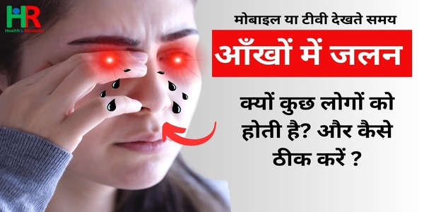 आँखों में जलन दूर करने के उपाय