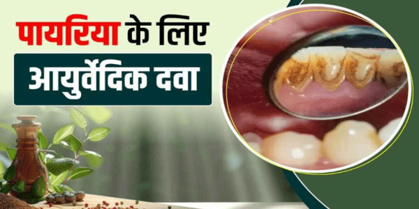 पायरिया के आयुर्वेदिक उपचार