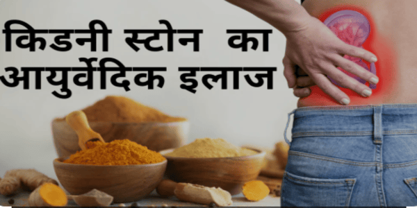 पथरी का सबसे बढि़या आयुर्वेदिक इलाज