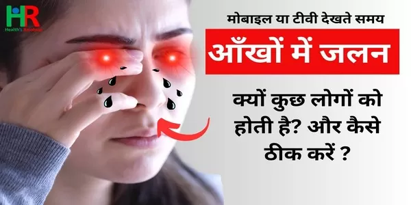 आँखों में जलन दूर करने के उपाय आँखों में जलन दूर करने के उपाय