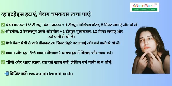 व्हाइटहेड्स व्हाइटहेड्स